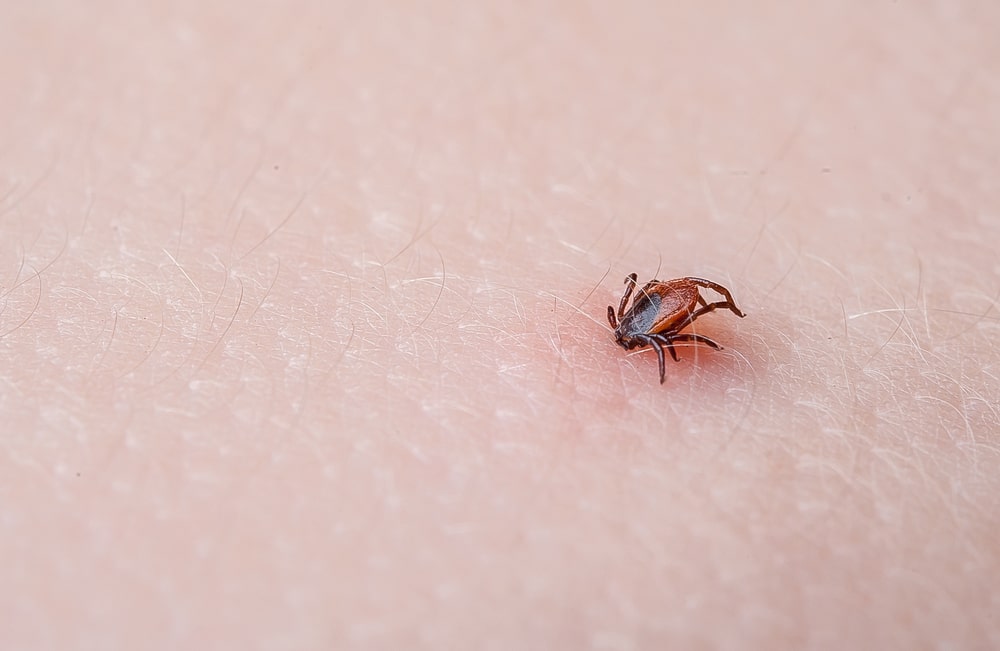 What causes lyme disease