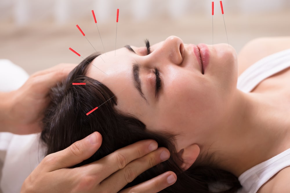 Acupuncture and massage