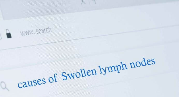 Swollen lymph nodes causes